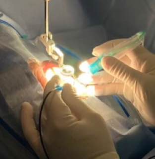 Отслоение сетчатки глаза операция цена